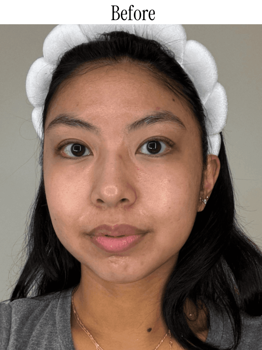 Medicube AgeR Booster Pro