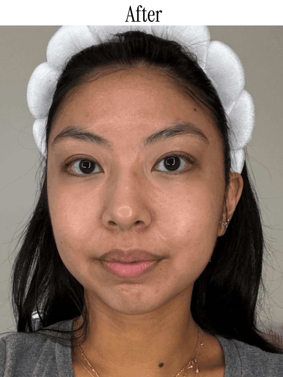 Medicube AgeR Booster Pro