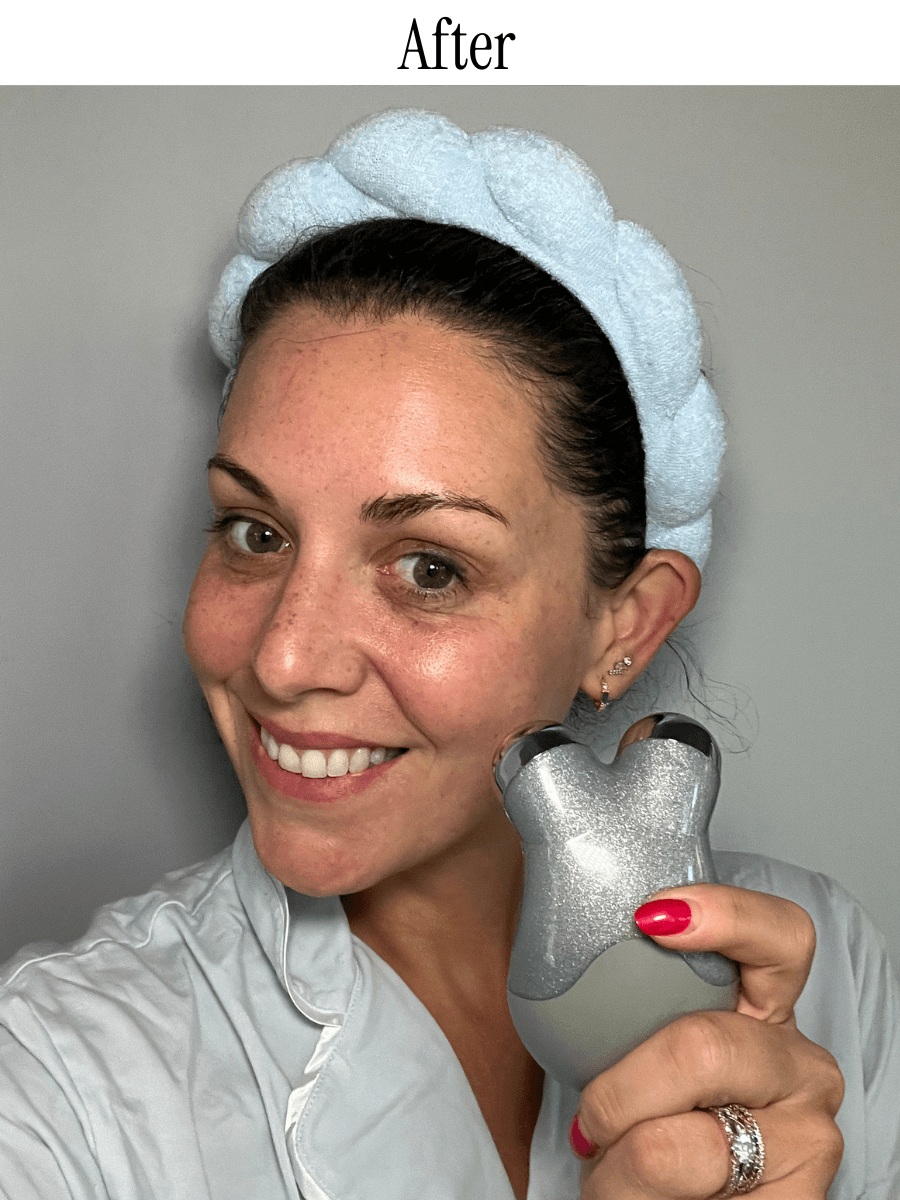 NuFace Trinity Starter Kit