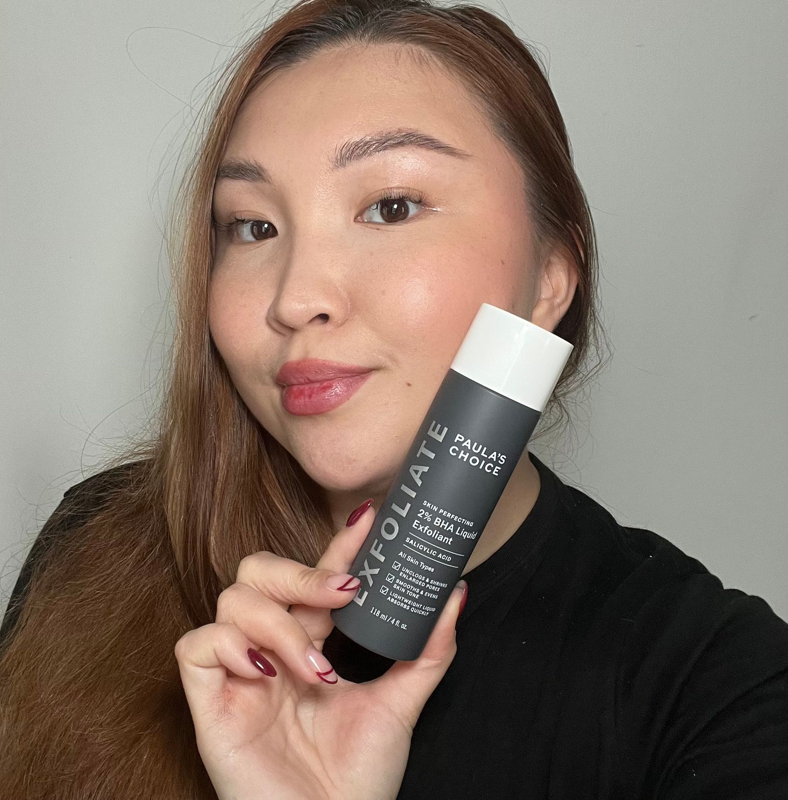 Denise Primbet's skin after using the Paula's Choice Skin Perfecting 2 BHA Liquid Exfoliant.