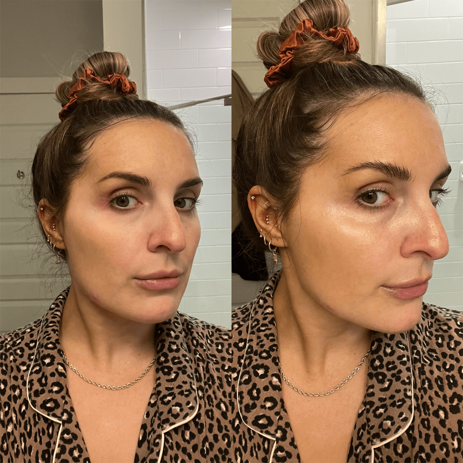 Before and after applying Cosrx Advanced Snail Mucin Cream