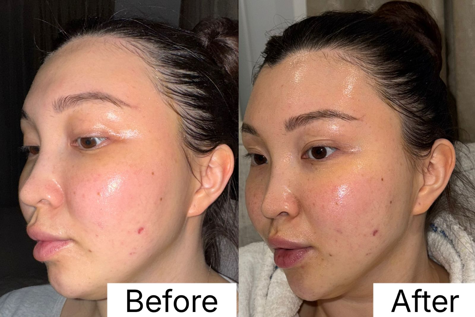 I Tested The ZIIP Halo Device For A Month My Honest Review