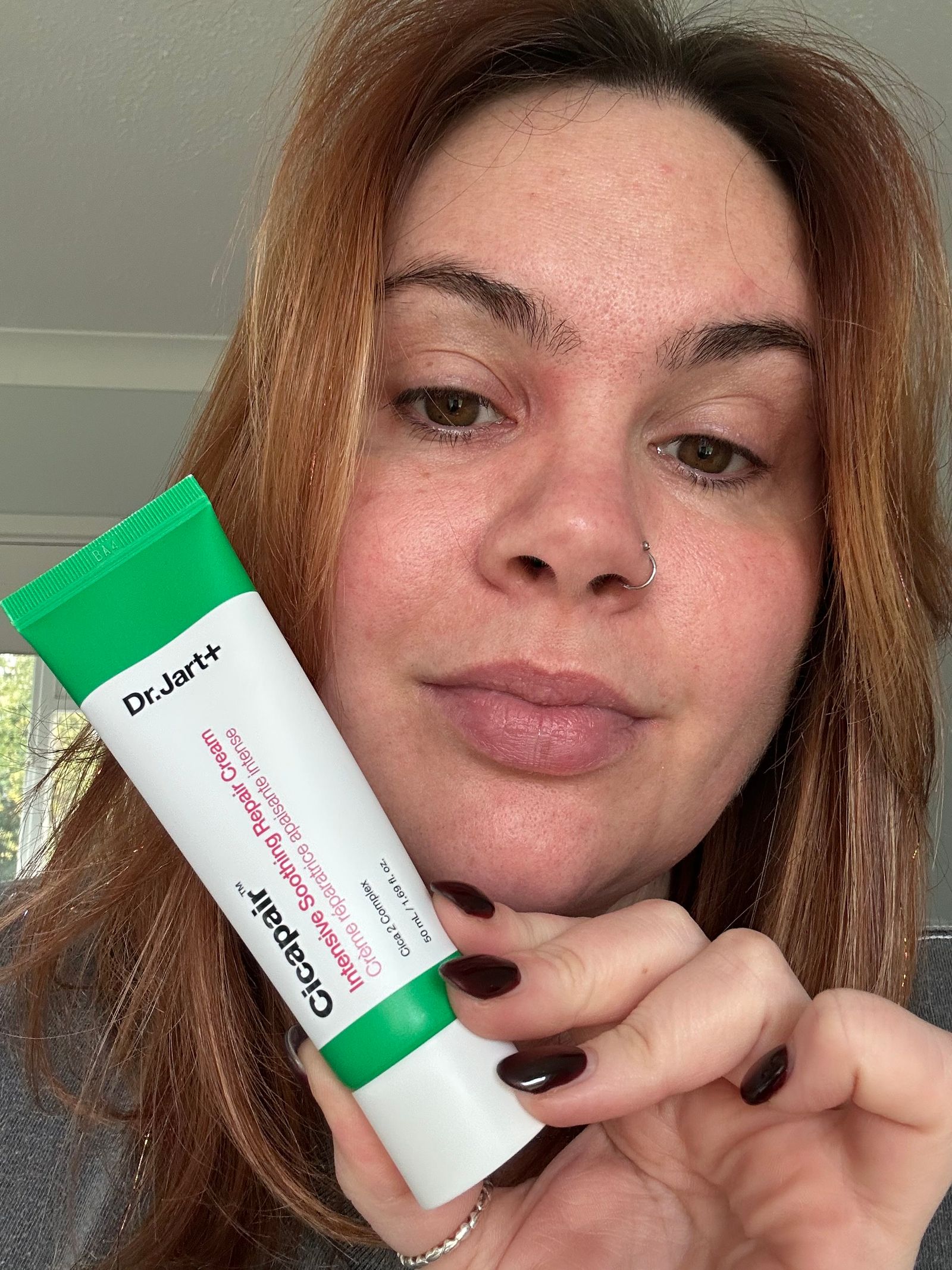 Lucy Partington testing the best rosacea creams at home.